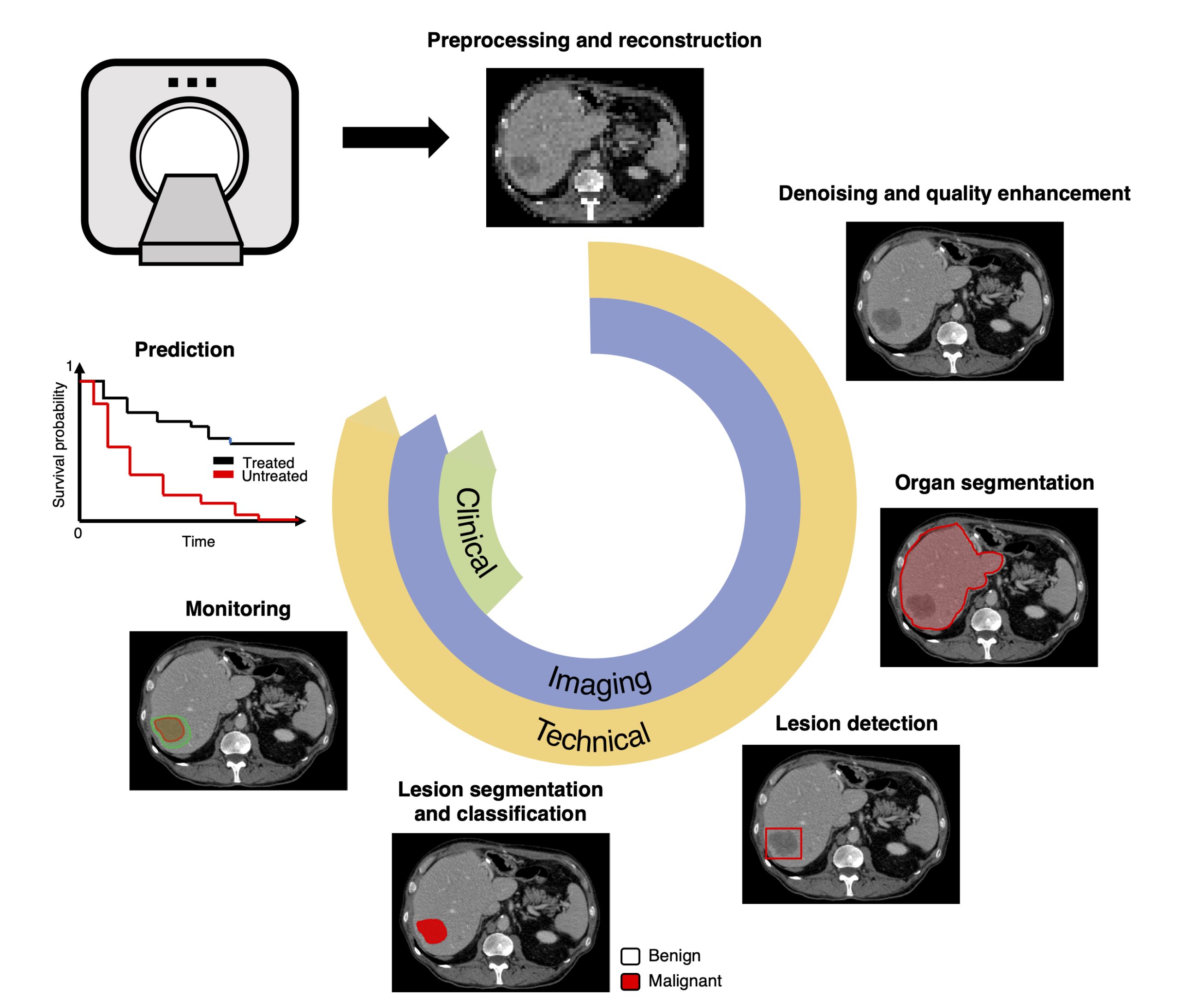 Artificial intelligence in medical imaging improving MRI and CT scan analysis for faster and more accurate diagnosis
